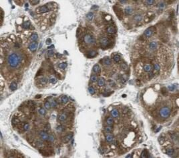 AHSG Antibody