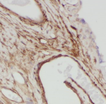 FBN2 Antibody