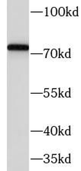 FBLN1 Rabbit Polyclonal Antibody