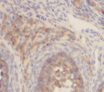 FST Antibody