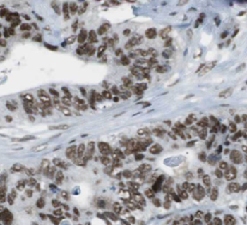 FUS Mouse Monoclonal Antibody