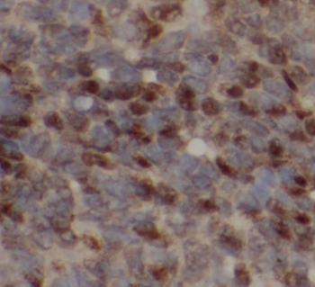 GAB3 Antibody