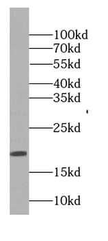 GAGE2D Rabbit Polyclonal Antibody