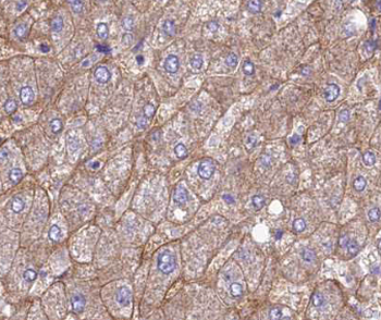 GAGE2D Rabbit Polyclonal Antibody
