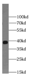 LGALS4 Antibody