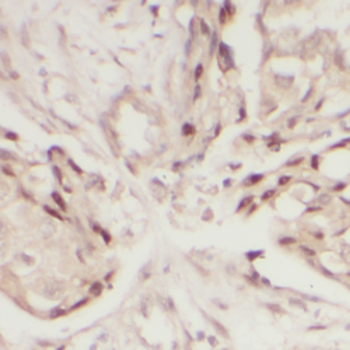 LGALS4 Antibody