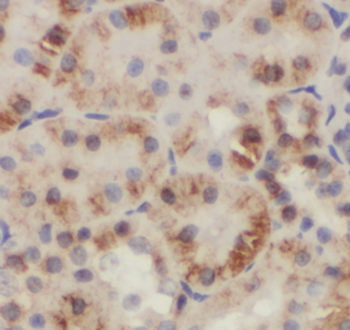 GDI2 Antibody