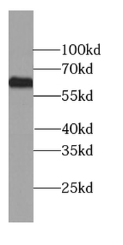 ARHGEF25 Antibody