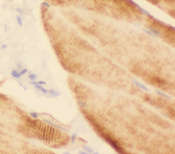 ARHGEF25 Antibody