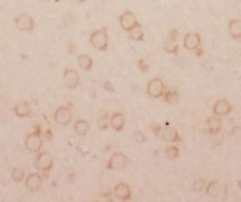 SLC1A3 Antibody