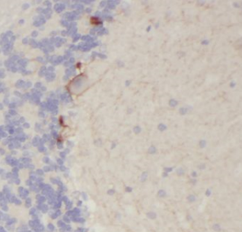 GLRA2 Antibody
