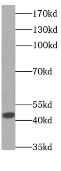 GOT1 Mouse Monoclonal Antibody