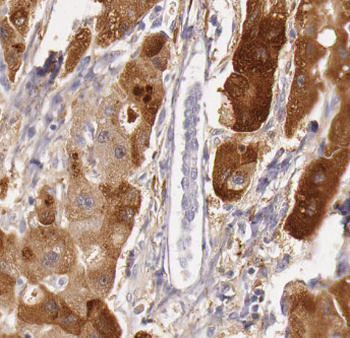 GOT1 Mouse Monoclonal Antibody
