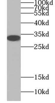 GP repeat Rabbit Polyclonal Antibody