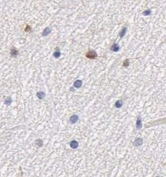 GP repeat Rabbit Polyclonal Antibody