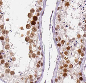 ADGRA1 Antibody