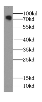 ARHGAP26 Rabbit Polyclonal Antibody