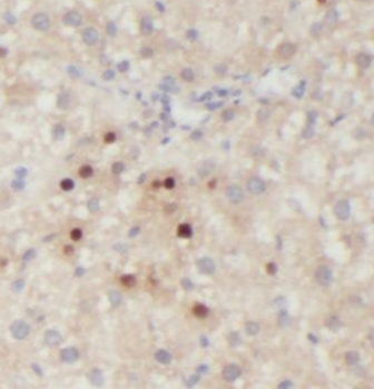 ARHGAP26 Antibody
