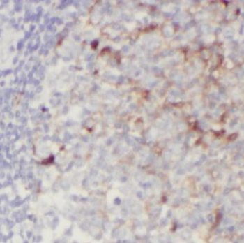 GCA Antibody