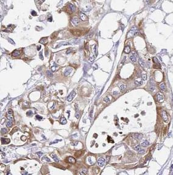 HSPA5 Antibody