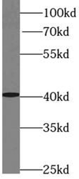 ADH5 Antibody
