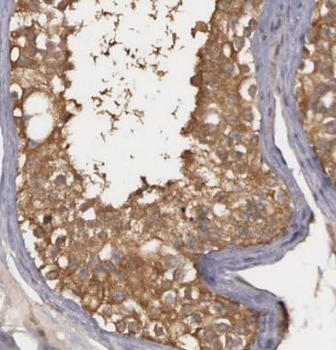 ADH5 Antibody