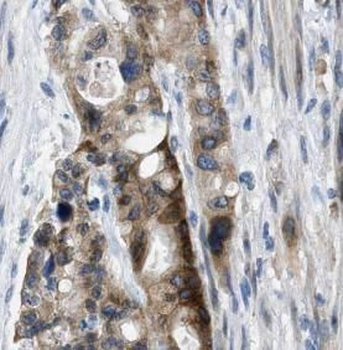 ADH5 Antibody