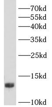 HBG1 Rabbit Polyclonal Antibody