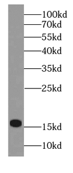 HBM Specific Rabbit Polyclonal Antibody