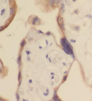 CGA Rabbit Polyclonal Antibody