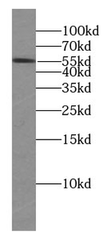 HDAC2 specific Rabbit Polyclonal Antibody
