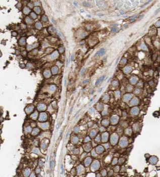 HDAC2 specific Rabbit Polyclonal Antibody