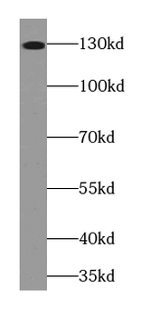 HDAC4 specific Rabbit Polyclonal Antibody