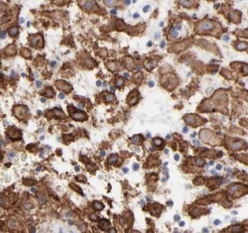 HBE1 Antibody