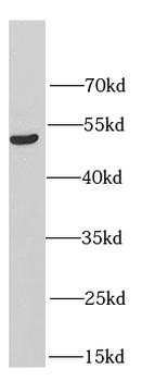 HERPUD1 Antibody