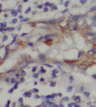 HERPUD1 Antibody