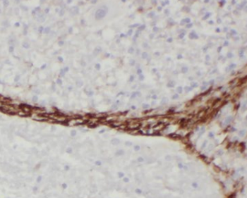 TGFB1I1 Antibody