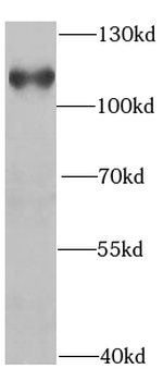 HIP1 Antibody