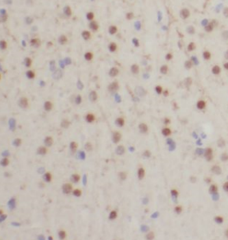 HIP1 Antibody