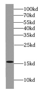 H2AC25 Rabbit Polyclonal Antibody
