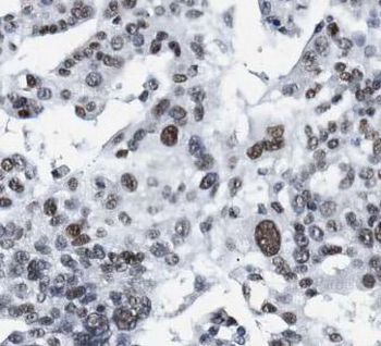 Histone H1.2 Antibody