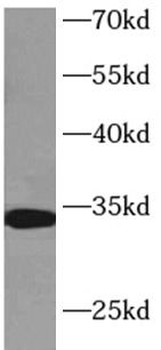 Histone H1.2 Rabbit Polyclonal Antibody