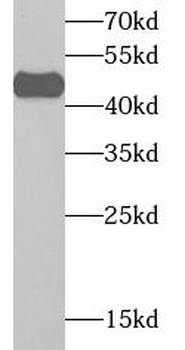 HLA A Rabbit Polyclonal Antibody