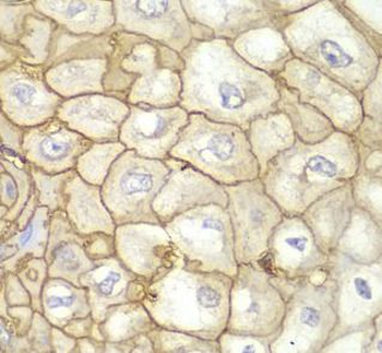 HLA A Rabbit Polyclonal Antibody