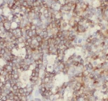 HLA-A Antibody
