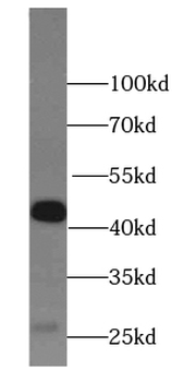 HLA B Rabbit Polyclonal Antibody