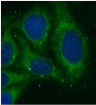 HLA B Rabbit Polyclonal Antibody
