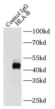 HLA B Rabbit Polyclonal Antibody