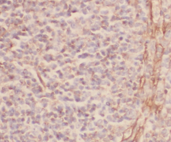 HLA B Rabbit Polyclonal Antibody