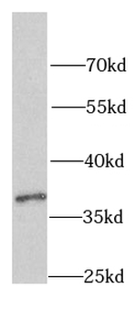 PCBP1 Antibody